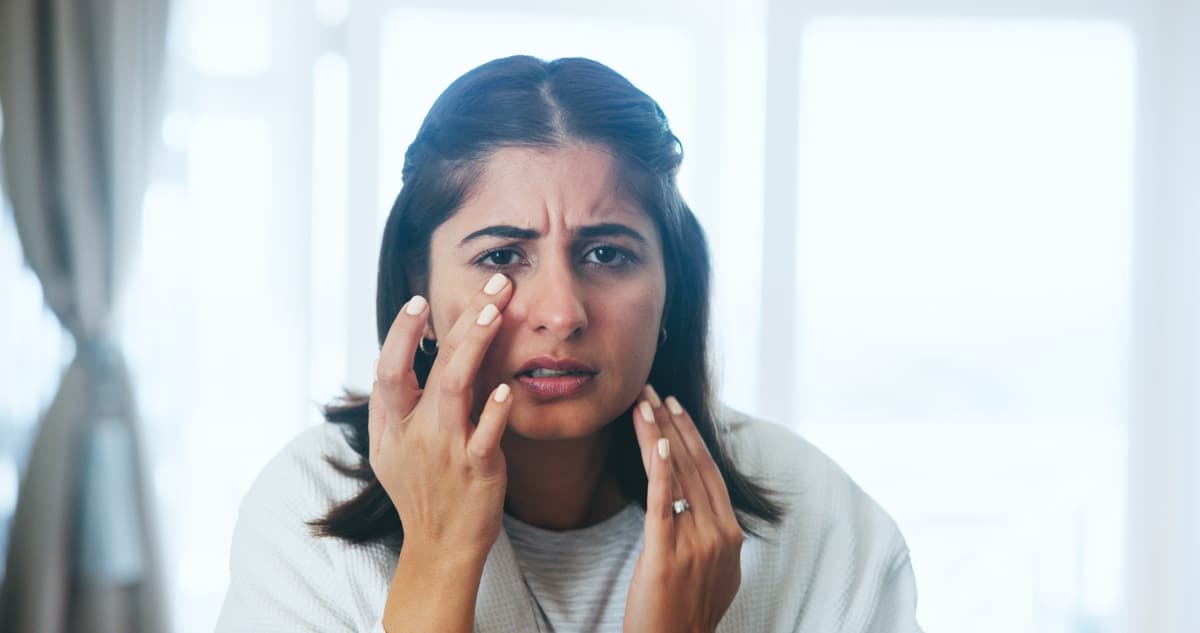 dark circles,dark circles get rid