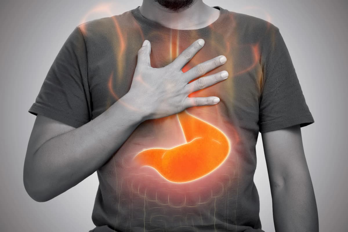 acidity home remedies; GERD relief naturally; acid reflux remedies