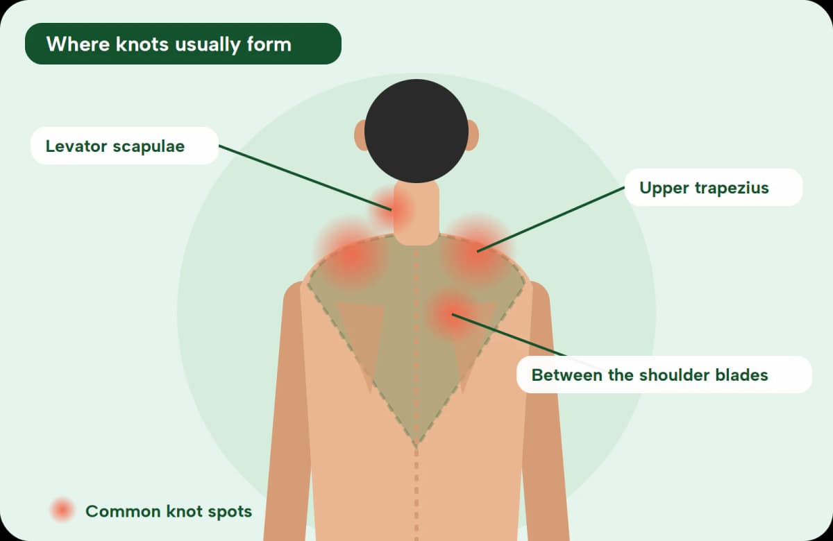 knots-in-neck-and-shoulder